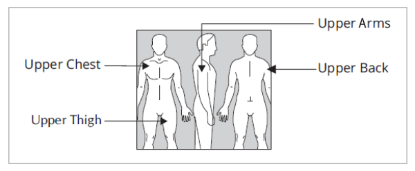Image showing where to apply EMSAM Image showing where to apply EMSAM
