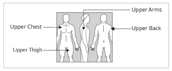 Image showing where to apply EMSAM